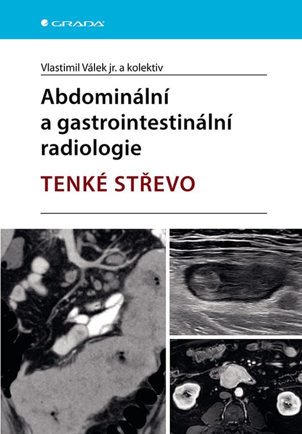 Abdominální a gastrointestinální radiologie - Tenké střevo – Válek Vlastimil