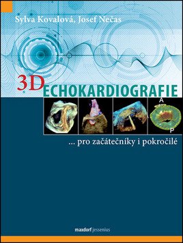 3D Echokardiografie – Sylva Kovalová, Josef Nečas