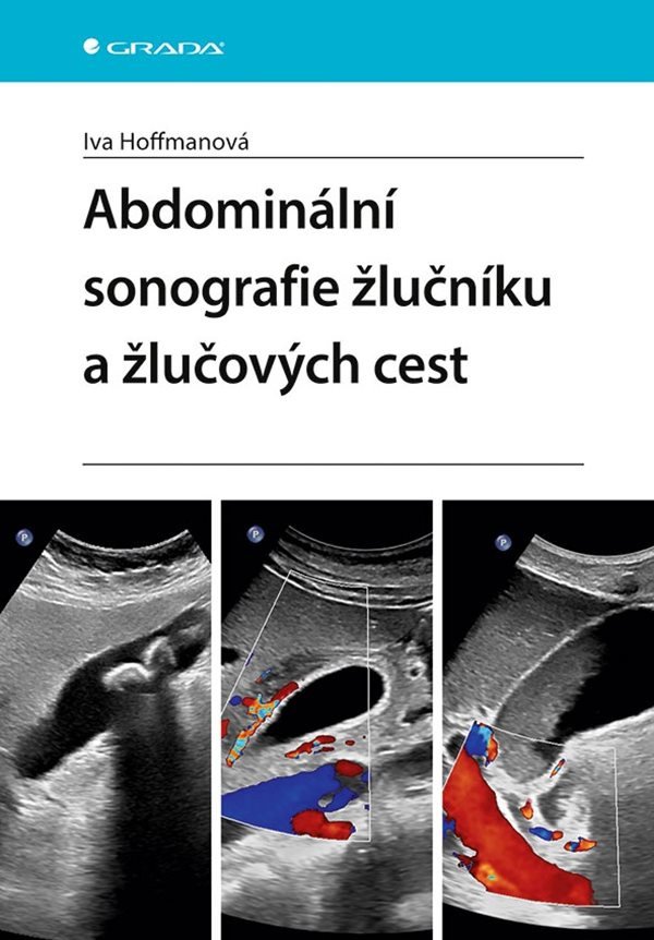 Abdominální sonografie žlučníku a žlučových cest – Iva Hoffmanová