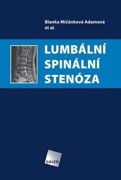 Lumbální spinální stenóza - Blanka Mičánková Adamová