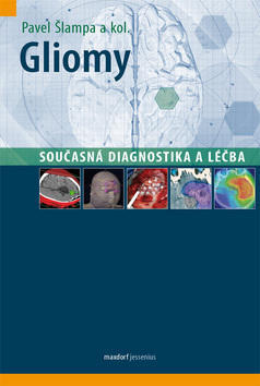 Gliomy - současná diagnostika a léčba - Pavel Šlampa