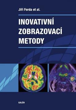 Inovativní zobrazovací metody - Jiří Ferda