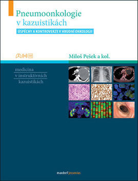 Pneumoonkologie v kazuistikách - Úspěchy a kontroverze v hrudní onkologii - Miloš Pešek