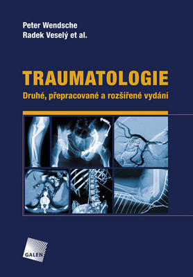 Traumatologie - Peter Wendsche; Radek Veselý