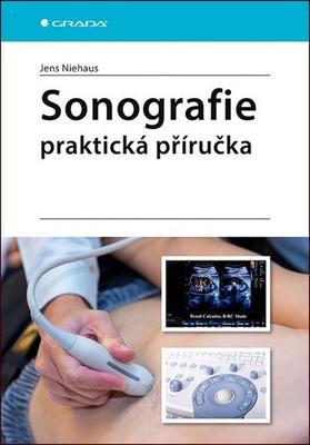 Sonografie Praktická příručka - Jens Niehaus