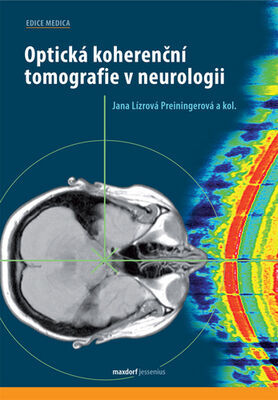 Optická koherenční tomografie v neurologii - Jana Lízrová Preiningerová