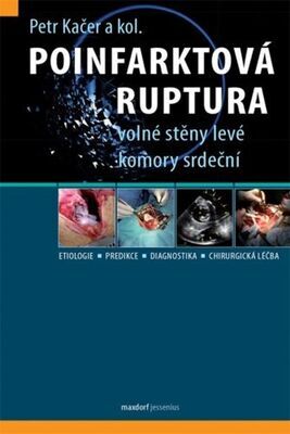 Poinfarktová ruptura - volné stěny levé komory srdeční - Petr Kačer