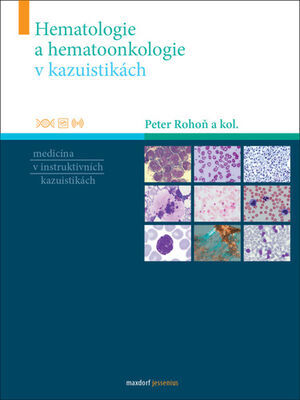 Hematologie a hematoonkologie v kazuistikách - Medicína v instruktivních kazuistikách - Peter Rohoň