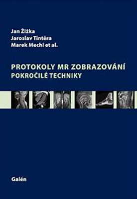 Protokoly v MR zobrazování - Pokročilé techniky - Jan Žižka; Marek Mechl; Jaroslav Tintěra