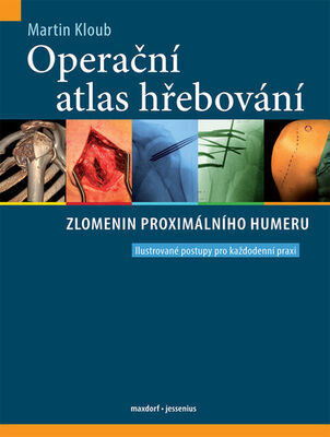 Operační atlas hřebování zlomenin proximálního humeru - Ilustrované postupy pro každodenní praxi - Martin Kloub