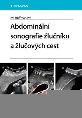 Abdominální sonografie žlučníku a žlučových cest - Iva Hoffmanová